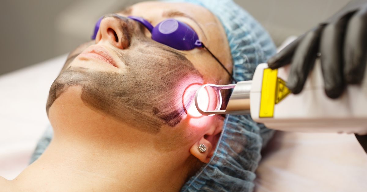 woman getting laser and woman getting facial peel